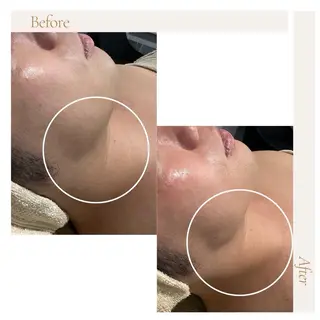 アイアンド ネイルデイのエステ・リラクイメージ