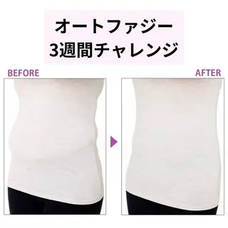 leolo武蔵浦和 肌質改善＆脱毛のエステ・リラクイメージ