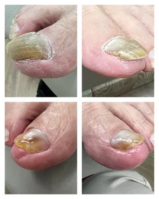 ネイル Belulu所属・Belulu ベルルのネイルデザイン