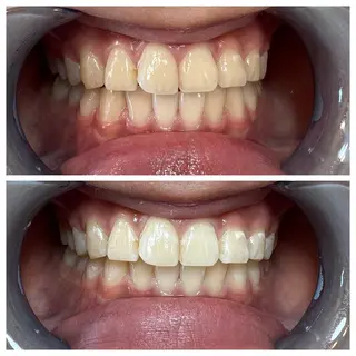 セルフホワイトニング Shineeのエステ・リラクイメージ