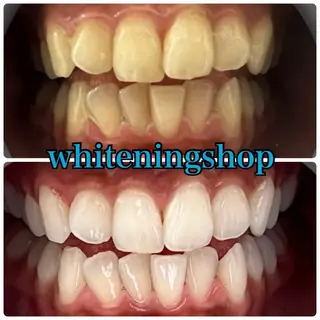 ホワイトニングショップせんげん台店所属・スタッフ 兎洞のその他イメージ