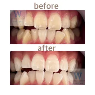 ホワイトニング ショップ本八幡店のエステ・リラクイメージ