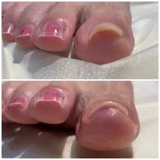 LIZERA&CO（charitesfam内）所属・南古谷　松本 かよのネイルデザイン