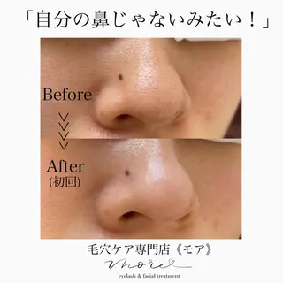 Eyelash salon MORE(モア)所属・安納 麻穂のエステ・リラクイメージ