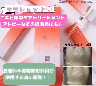 美肌脱毛サロン　Mercury所属・美肌脱毛サロン Mercuryのエステ・リラクイメージ