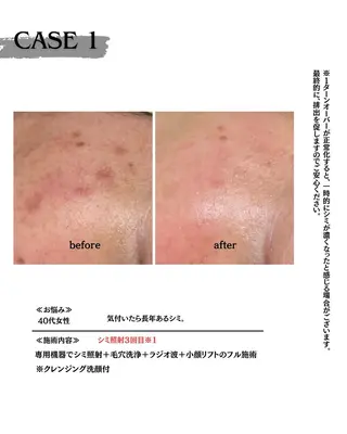 素肌育成・シミケア専門サロン美潤-miulu-所属・【医療提携サロン】 【シミケア専門】のエステ・リラクイメージ