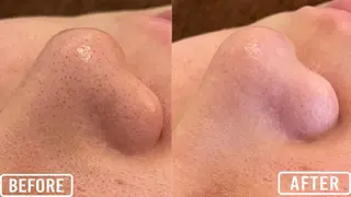 毛穴/毛穴洗浄専門 エミルカ船橋のエステ・リラクイメージ