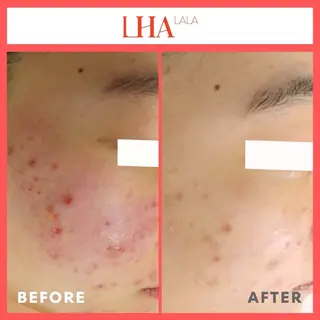 VERY VERY九条店所属・VERY VERY 九条店のエステ・リラクイメージ