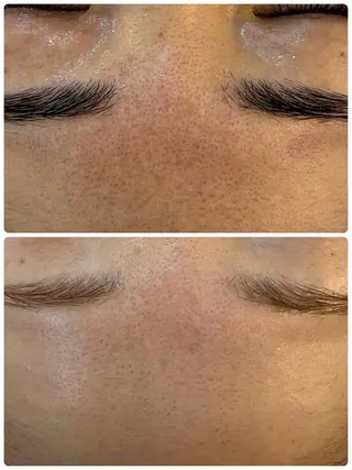 ブライダルエステ&肌管理OGUMO所属・肌管理 OGUMOのエステ・リラクイメージ