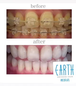 メンズ ホワイトニングサロン EARTH福岡姪浜店のその他イメージ