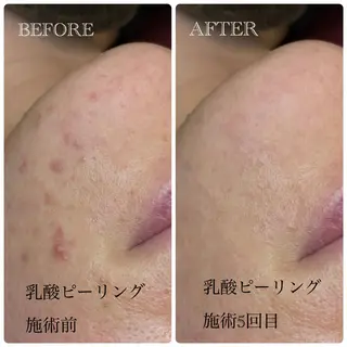 Crescent Beautyのエステ・リラクイメージ