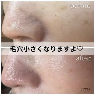 ECXIA 【エクシア】のエステ・リラクイメージ