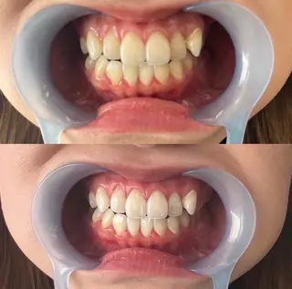 ララホワイトニング  大分駅前店所属・ララホワイトニング 大分駅前店のその他イメージ