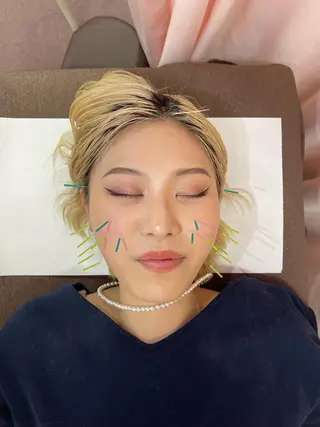 同心整骨院 美容鍼・整体・小顔のエステ・リラクイメージ