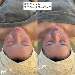 うなじ脱毛/美肌脱毛 LABELのエステ・リラクイメージ