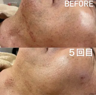 メンズ EARTH coiffure beaute 小山店所属・EARTH 小山店 shimaのエステ・リラクイメージ