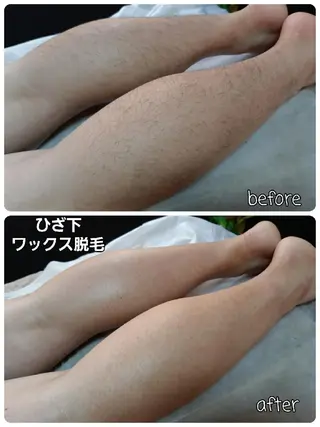 メンズ メンズ・脱毛サロン DEARS所属・山村幸久　メンズ脱毛 ディアーズのエステ・リラクイメージ