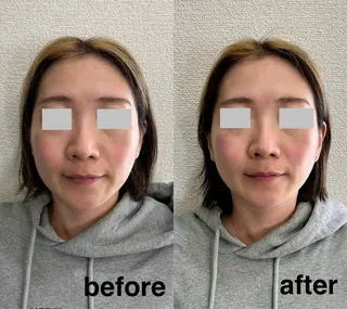 Recellage所属・Recellage リセラージュのエステ・リラクイメージ