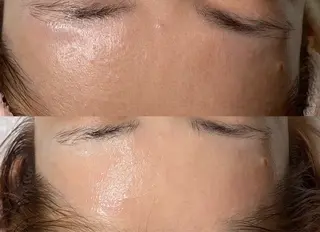 BLOOMi.(CARRIE NAIL内)所属・肌悩み専門店 BLOOMi.のエステ・リラクイメージ