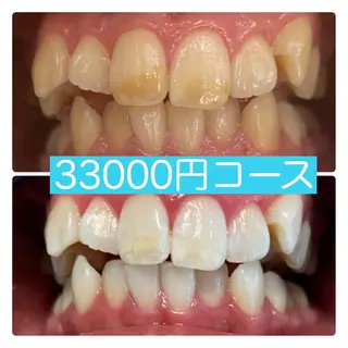 PLATINUM Beauty 横浜店所属・ホワイトニングルーム 横浜店のその他イメージ