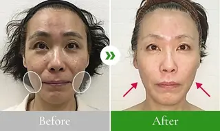 小顔整体研究所 KSラボ川崎店内田のエステ・リラクイメージ