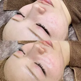 Lei beauty salon所属・松ヤニワックス専門/ 梅田/Leiのエステ・リラクイメージ