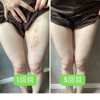 リラクゼーション ～絃～のエステ・リラクイメージ