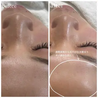 Lereve 三宮店所属・Lereve .三宮店のエステ・リラクイメージ