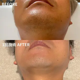 メンズ Lassy Yuriの眉毛・アイブロウイメージ