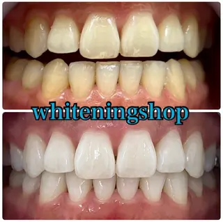 ホワイトニング ショップ吉祥寺店のエステ・リラクイメージ