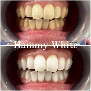 HammyWhite 心斎橋🌈AMIのその他イメージ