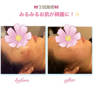 ダイエット・美肌ケア fleurのエステ・リラクイメージ