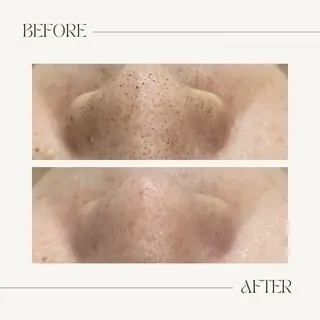 CEsalonEgg 齋藤のエステ・リラクイメージ