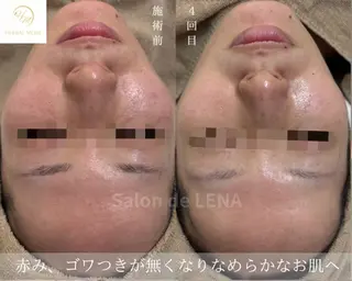 ハーブピーリング・毛穴ケア専門サロンSalon de LENA 栄店所属・ハーブピーリング専門 サロンドレナ　白藤のエステ・リラクイメージ