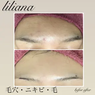 LILIANA所属・LILIANA ☆YURIのエステ・リラクイメージ