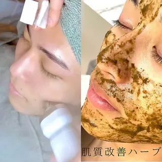 メンズ 毛の専門店BALDER.所属・men'sのトータル 美容👨✨ヒロのエステ・リラクイメージ