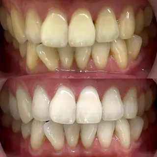 LBSホワイトニング 銀座店💎公式のその他イメージ