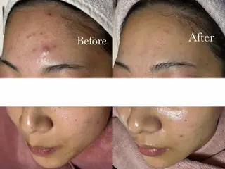 SHELLY 池本知香のエステ・リラクイメージ