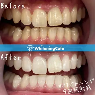 ホワイトニングカフェ徳島沖浜店所属・ホワイトニングカフェ 徳島沖浜店のエステ・リラクイメージ