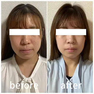 小顔サロン AMYONのエステ・リラクイメージ