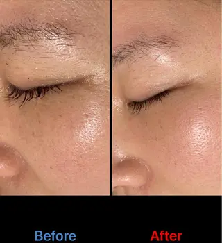 CEサロンblanc bebe所属・高村 有紀のエステ・リラクイメージ