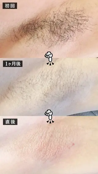 Hit. シュガーリング豊橋のエステ・リラクイメージ