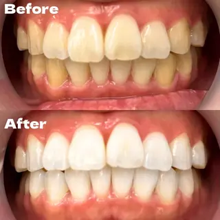 LBSホワイトニング 銀座店💎公式のその他イメージ