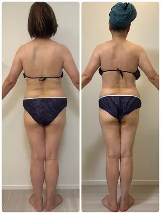 デトックス×ボディメンテナンスサロンShikhara（シカラ）所属・オールハンド筋膜痩身 整体/小顔　中山朝美のエステ・リラクイメージ