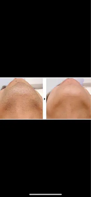 メンズ e.cia所属・ecia 脱毛/豊田/浄水のエステ・リラクイメージ