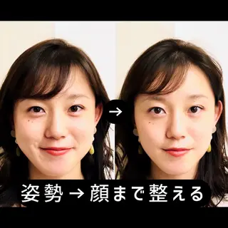 渋谷 小顔美容鍼 専門サロン YZのエステ・リラクイメージ