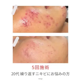 ベラージュ【美背中・ 美尻・フェイシャル】のエステ・リラクイメージ