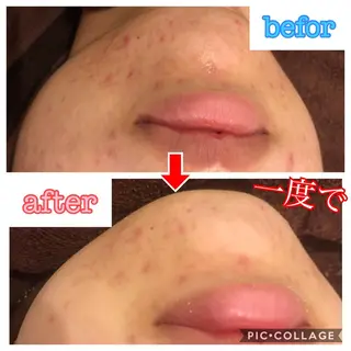 セミロング カラー パーマ ヘアアレンジ メンズ キッズ ネイル マツエク・マツパ 四つ星サロン🎖 腸＆ニキビケアに特化のエステ・リラクイメージ