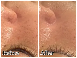 Gemini 　MIKIのエステ・リラクイメージ