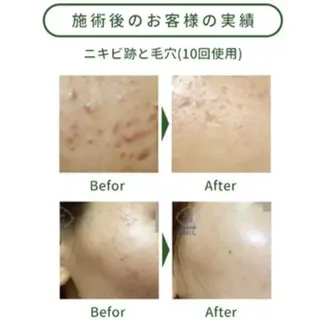 Jeliss~美爪育成ネイル＆頭蓋骨小顔矯正サロン~所属・美顔(小顔)矯正& 美爪育成Jelissのエステ・リラクイメージ